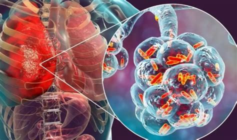  Nanosilica: Biyomalzemelerde Yeni Bir Çağ mı Başlıyor?